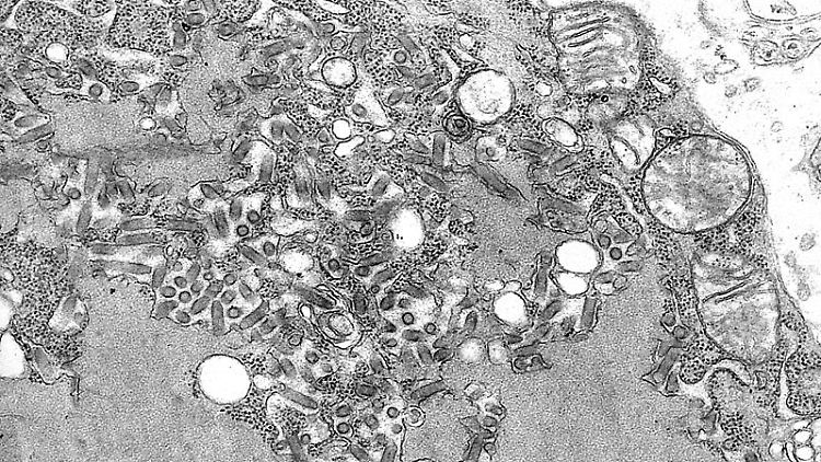 Patient infiziert sich durch Organtransplantation mit tödlichem Virus