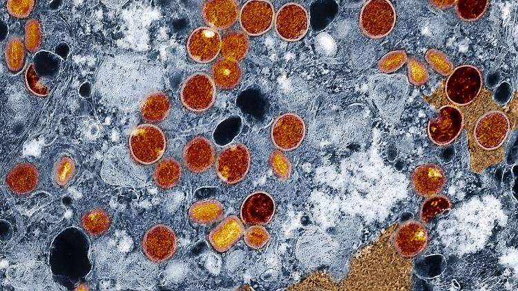 Experten warnen vor globaler Bedrohung durch Mpox
