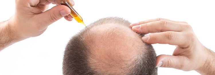 Hilft Rosmarin gegen Haarausfall?