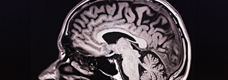 Neues Tool sagt individuelles Sterberisiko voraus