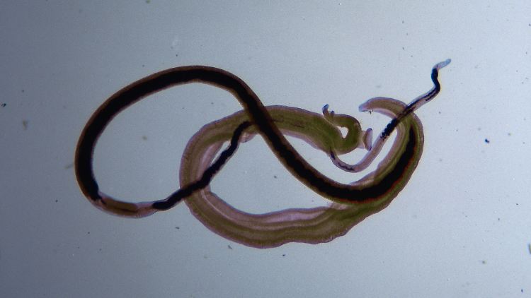 Hat jeder Mensch Würmer im Körper?