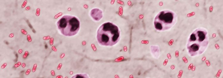 Camper infiziert sich mit der Pest in Kalifornien