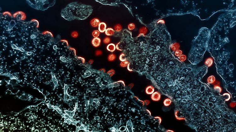 Neuer Antik&ouml;rper zeigt gro&szlig;e Wirksamkeit gegen HIV