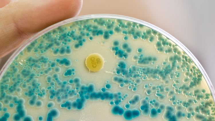 Antibiotika-Resistenz ist schneller als medizinische Entwicklung