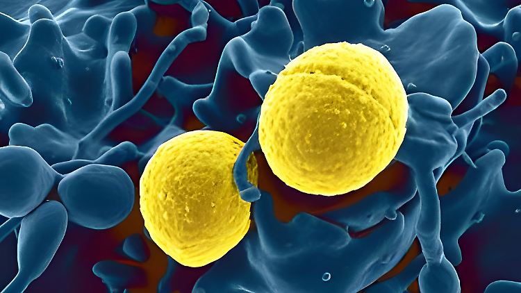 Forscher befürchten Todeswelle durch Krankenhauskeime